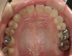 no.31_7964_治療前_上 .JPG