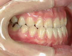 no.31_7964_治療前_右 .JPG