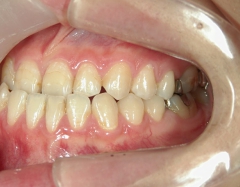 no.31_7964_治療前_左 .JPG