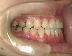 no.31_7964_治療後_右 .JPG