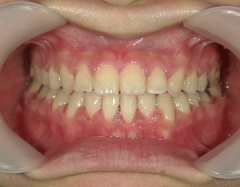 no.31_7964_治療後_正面 .JPG