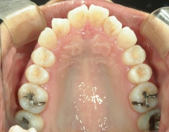 no.41_ 8994_治療前_上.JPG